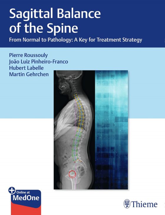 Sagittal Balance of the Spine Original PDF