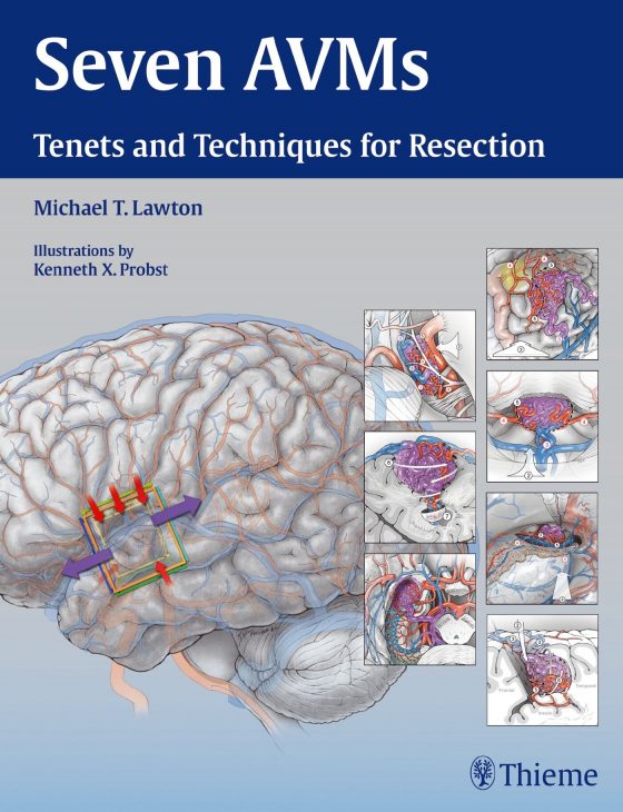 Seven AVMs Original PDF