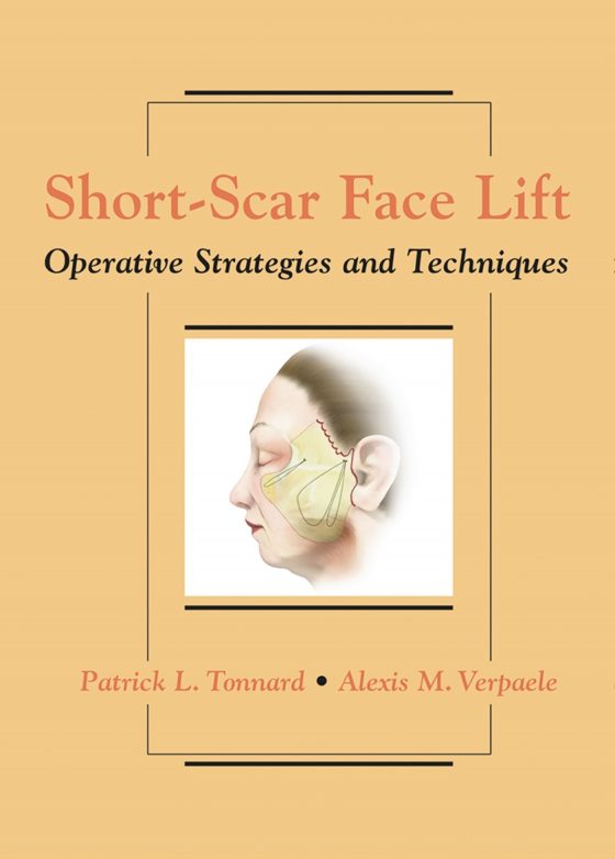 Short-Scar Face Lift Original PDF