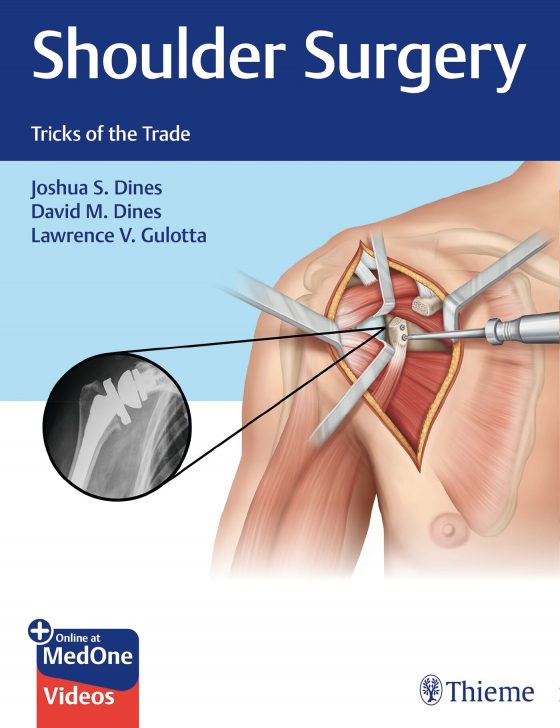 Shoulder Surgery Original PDF