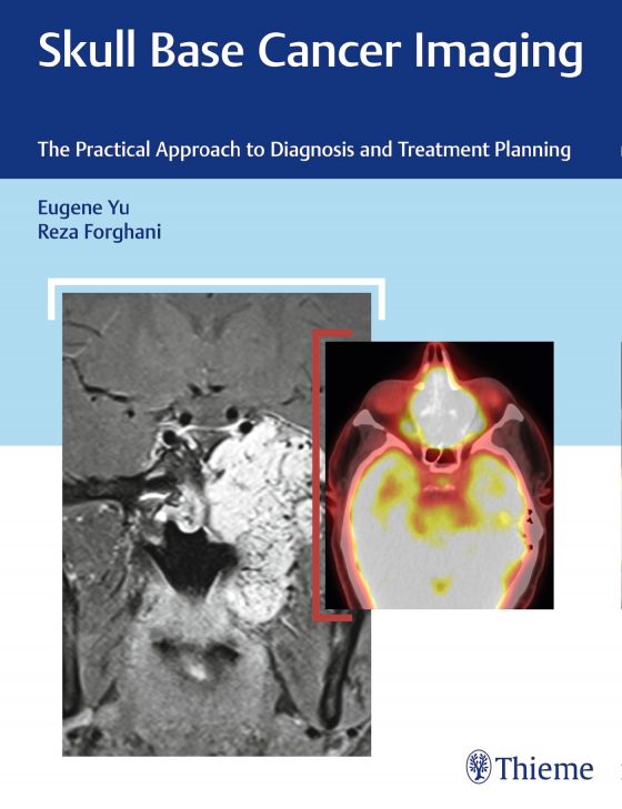 Skull Base Cancer Imaging Original PDF
