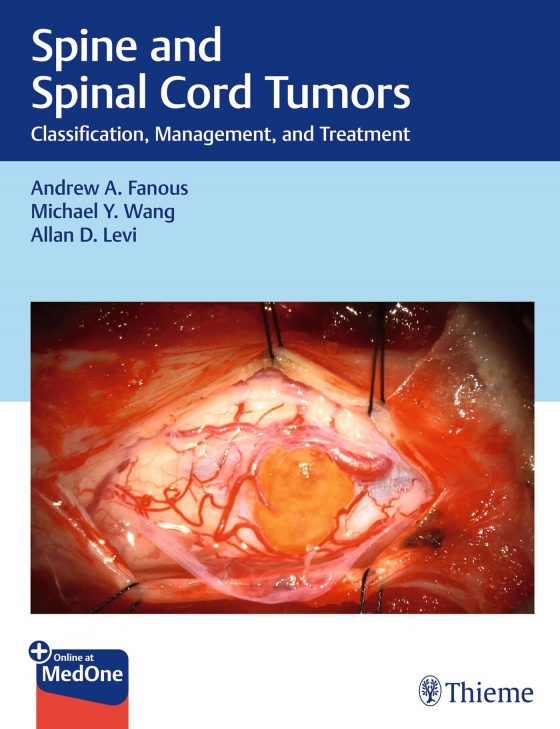 Spine and Spinal Cord Tumors Original PDF