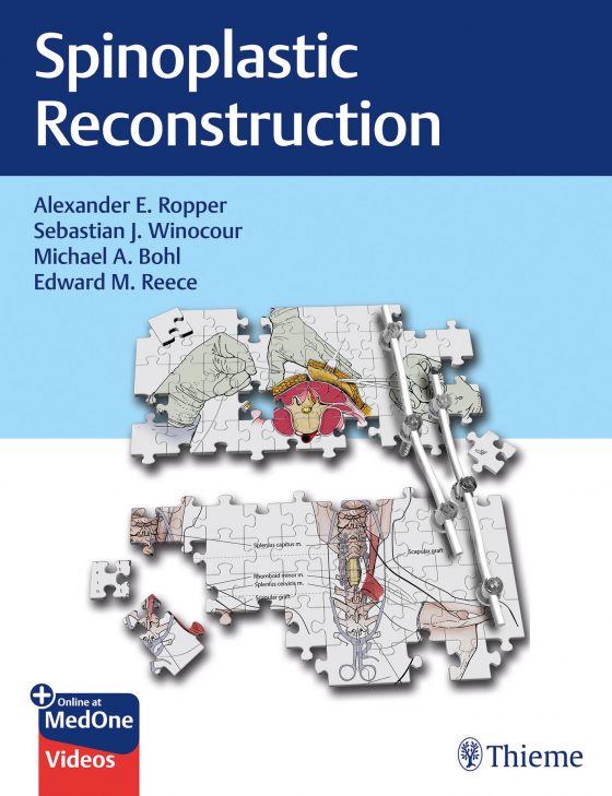 Spinoplastic Reconstruction Original PDF