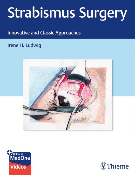 Strabismus Surgery Original PDF