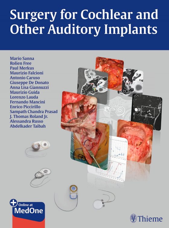 Surgery for Cochlear and Other Auditory Implants Original PDF