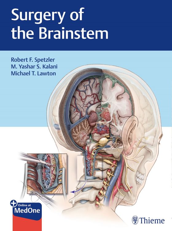 Surgery of the Brainstem Original PDF