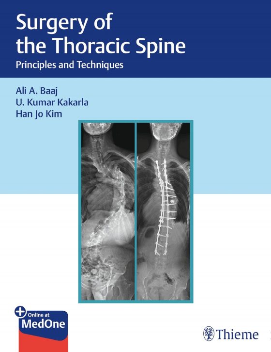 Surgery of the Thoracic Spine Original PDF