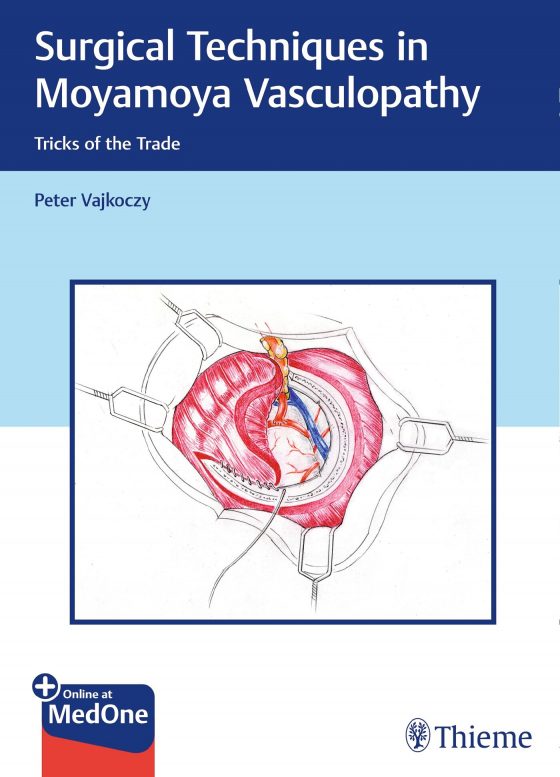 Surgical Techniques in Moyamoya Vasculopathy Original PDF