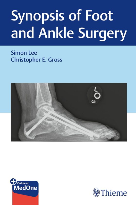 Synopsis of Foot and Ankle Surgery Original PDF