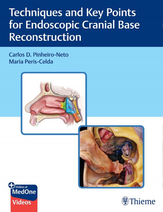 Techniques and Key Points for Endoscopic Cranial Base Reconstruction Original PDF