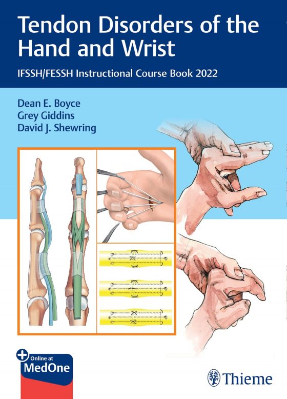 Tendon Disorders of the Hand and Wrist Original PDF