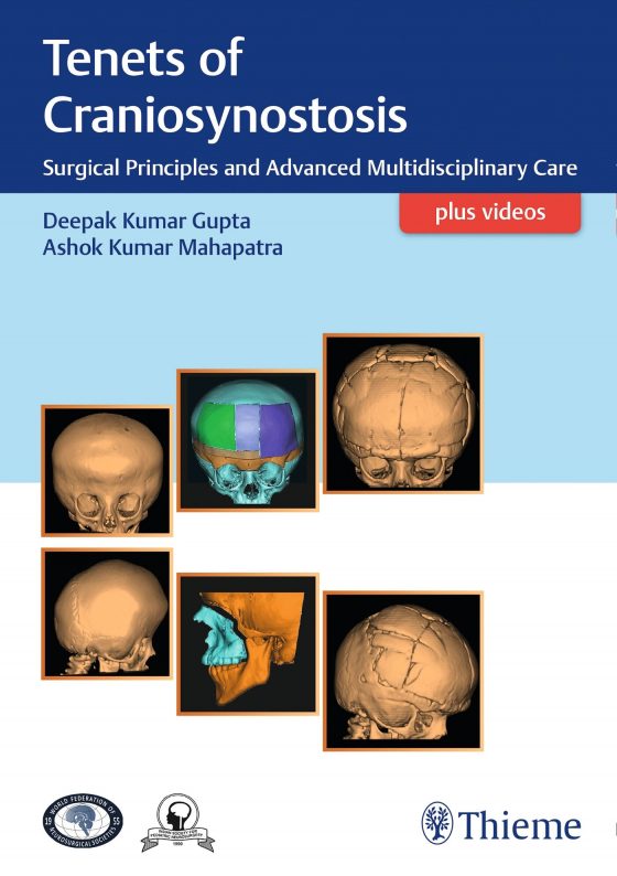 Tenets of Craniosynostosis Original PDF