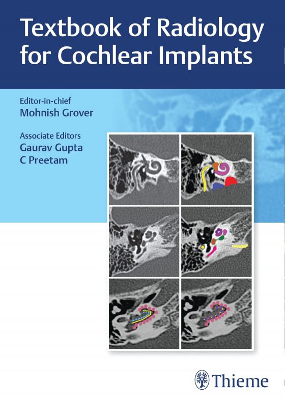 Textbook of Radiology for Cochlear Implants Original PDF