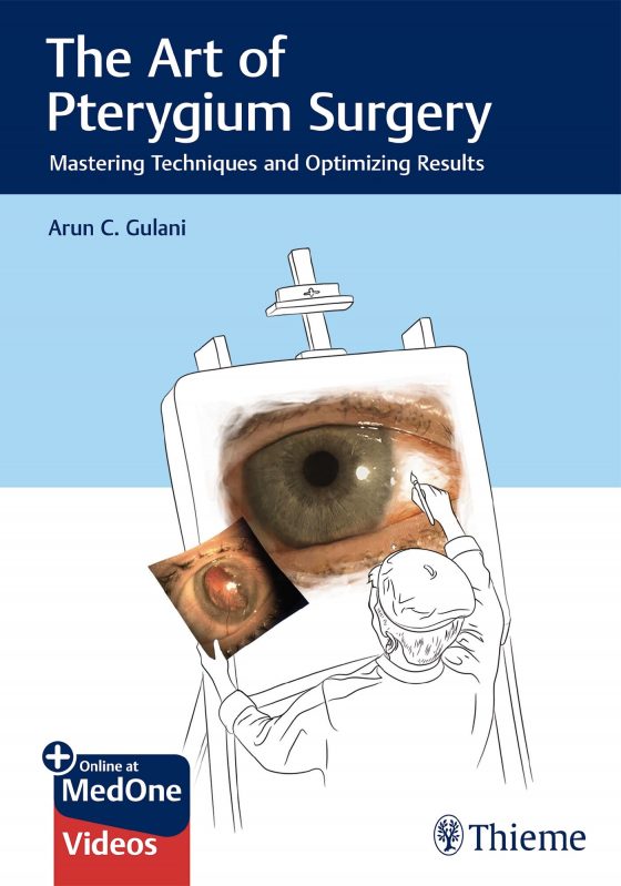 The Art of Pterygium Surgery Original PDF