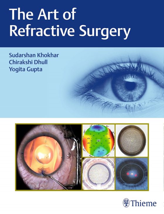 The Art of Refractive Surgery Original PDF