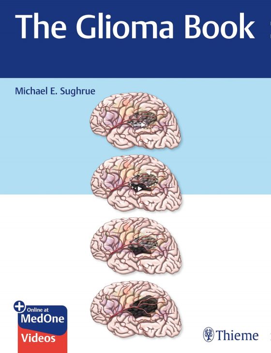 The Glioma Book Original PDF