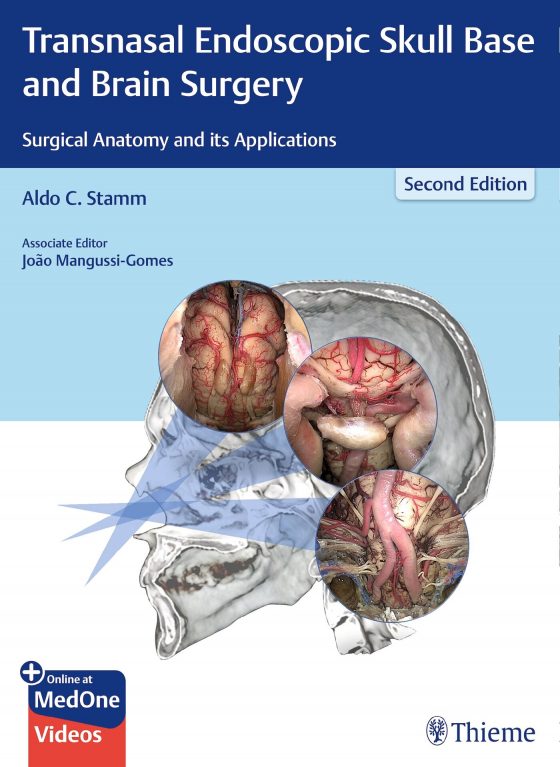 Transnasal Endoscopic Skull Base and Brain Surgery Original PDF