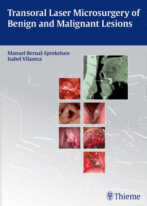 Transoral Laser Microsurgery of Benign and Malignant Lesions Original PDF