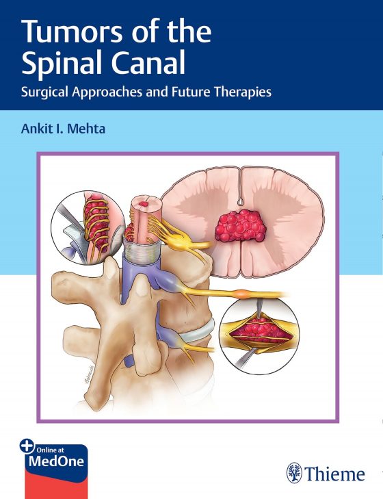 Tumors of the Spinal Canal Original PDF