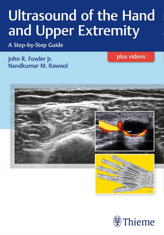 Ultrasound of the Hand and Upper Extremity Original PDF