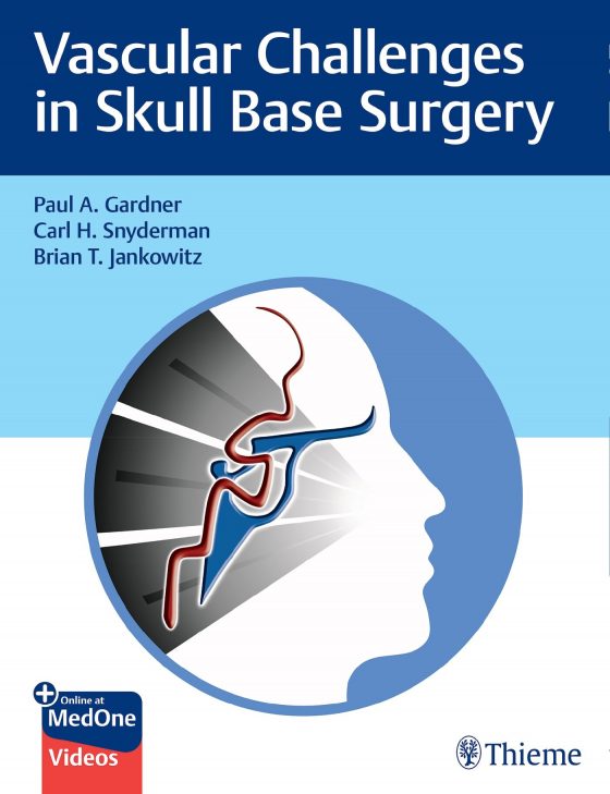 Vascular Challenges in Skull Base Surgery Original PDF