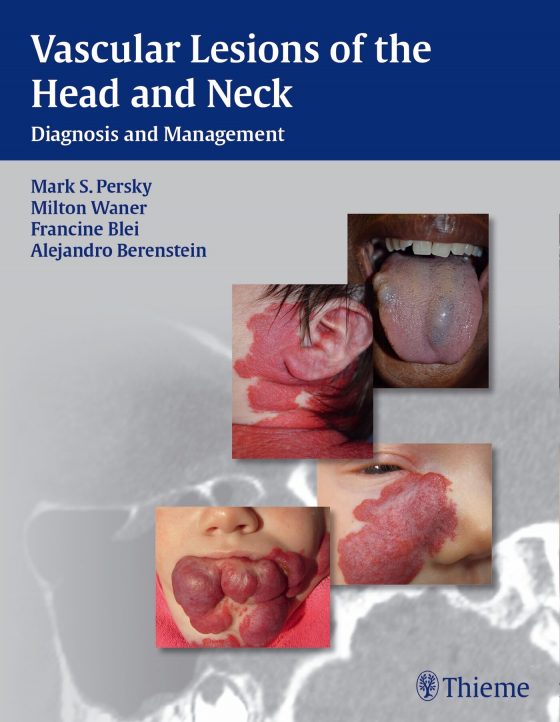 Vascular Lesions of the Head and Neck Original PDF