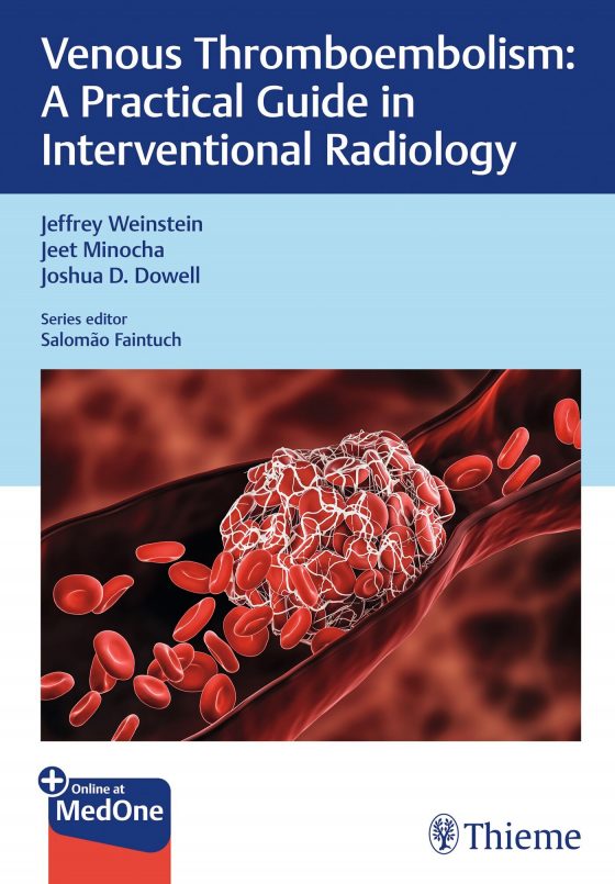 Venous Thromboembolism Original PDF