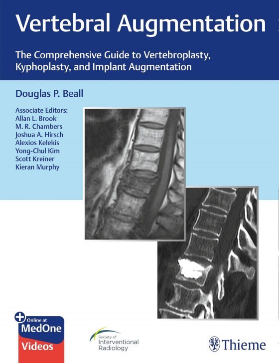 Vertebral Augmentation Original PDF