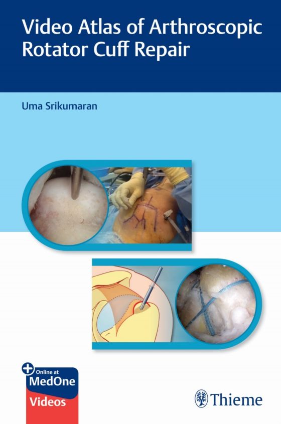 Video Atlas of Arthroscopic Rotator Cuff Repair Original PDF