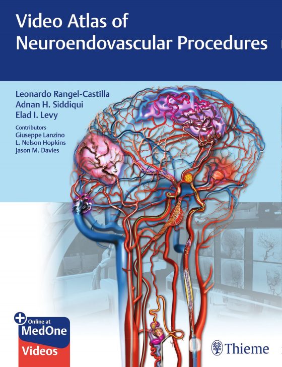 Video Atlas of Neuroendovascular Procedures Original PDF
