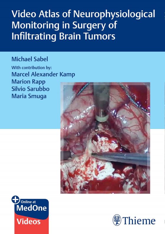 Video Atlas of Neurophysiological Monitoring in Surgery of Infiltrating Brain Tumors Original PDF