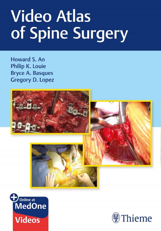 Video Atlas of Spine Surgery Original PDF